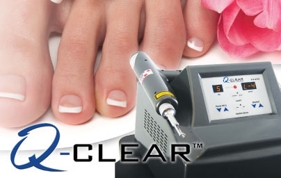 laser-toe-treatment-podiatry-of-arlington-heights.webp
